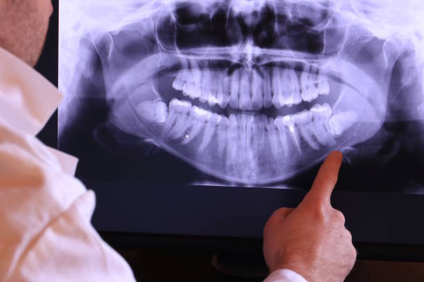 Best Emergency Tooth Extraction  in Cairo, NE