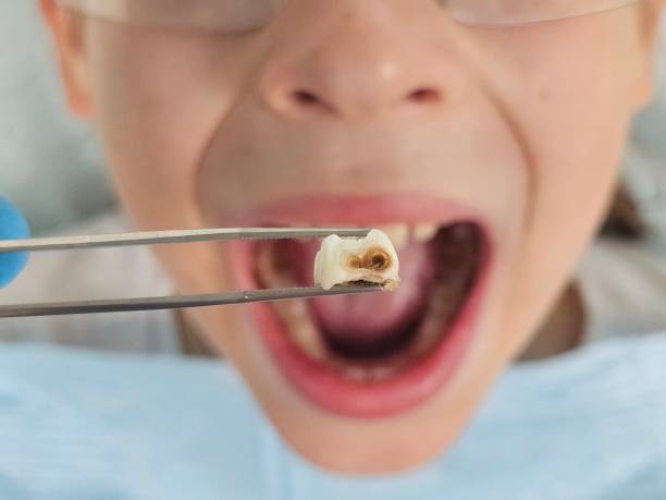 Dentist for Dental Trauma in NE